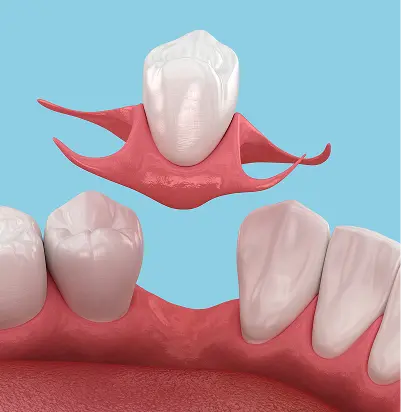 Restoring Congenitally Missing Teeth